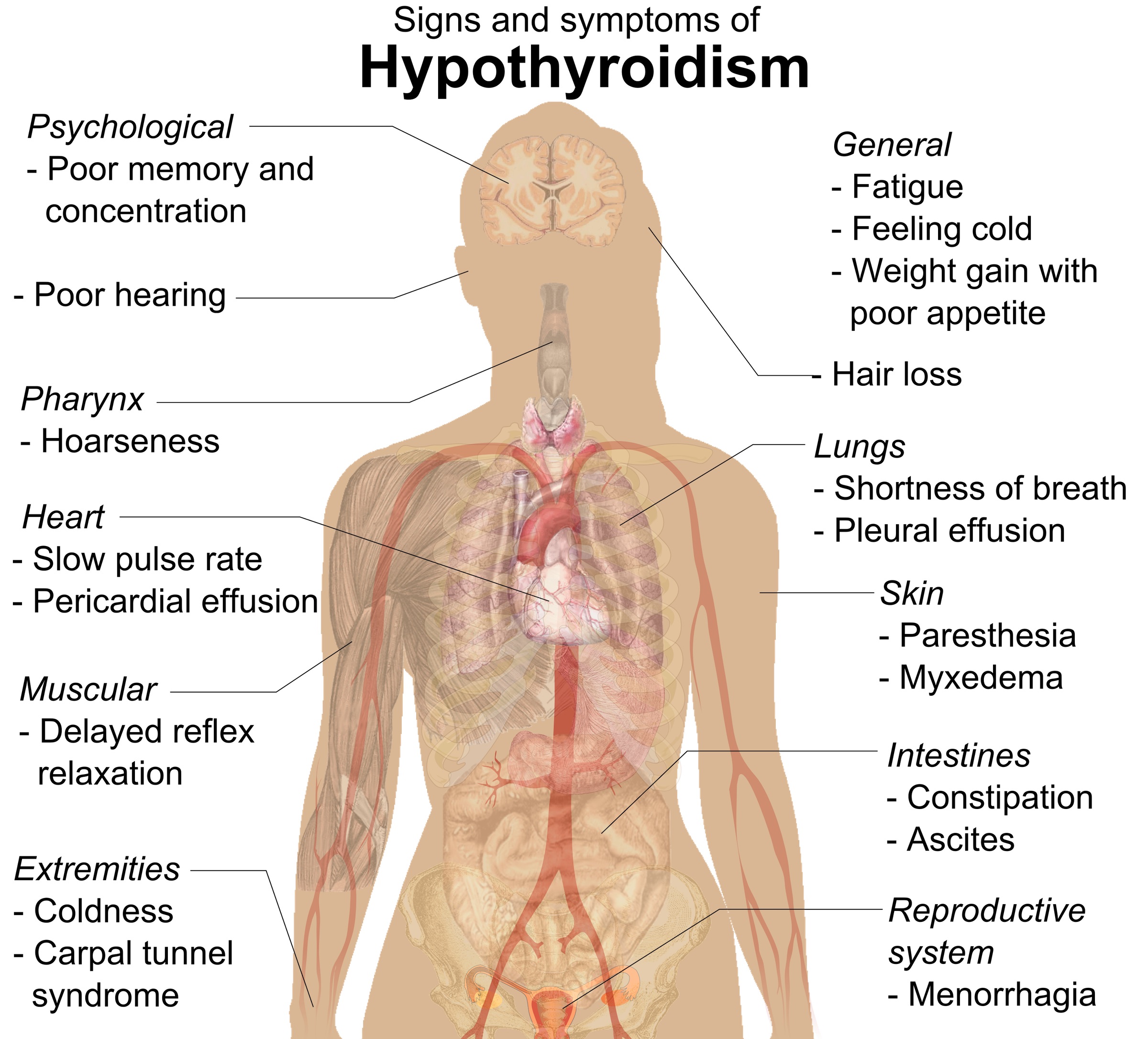 Signs_and_symptoms_of_hypothyroidism
